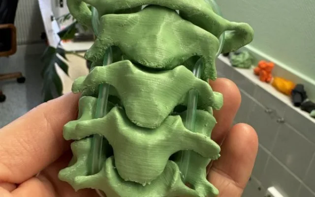 Lékaři v Brně používají 3D modely kostí a orgánů, aby lépe operovali