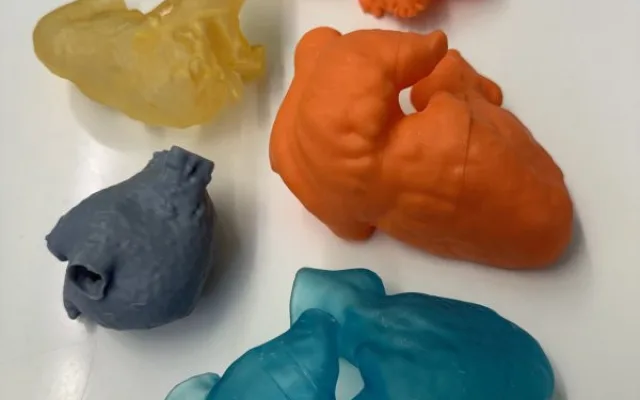 Lékaři v Brně používají 3D modely kostí a orgánů, aby lépe operovali