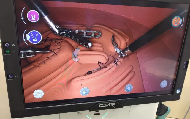 Lékaři v Brně povolají na sál nového robota. Pomůže při operacích plic a střev