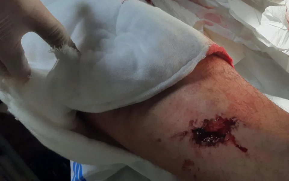 Brutální napadení na Vyškovsku. Agresor zmlátil muže na lavičce a poštval proti němu psa