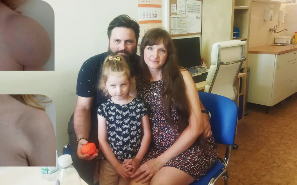 Verunku od narození trápila boule na ruce, pomohla až operace