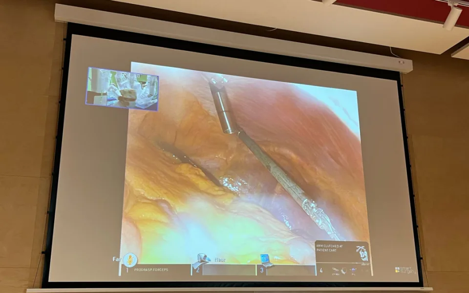 VIDEO: V brněnské nemocnici pořídili lékařům robotického kolegu. Stroj usnadní některé operace